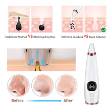 Load image into Gallery viewer, Electric Vacuum Pore Cleaner Deep Cleansing Skin Care Machine